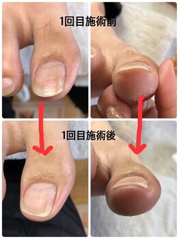 ラリベルテ(La liberte)/～フットケア～