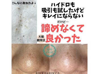 リッカロッカ(RIKKA&ROCCA)/お客様満足度No.1