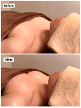 アンシャンテ(ENCHANTER)/光バストアップ