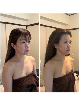 にっこりビューティー/★EMSマッサージ+エアバリ