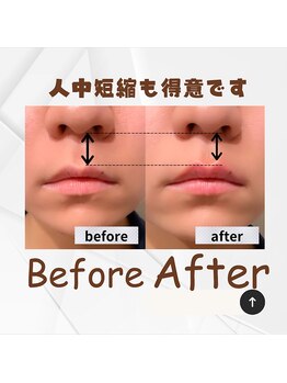 ワイズ 沖縄うるま院(Medical Y's)/人中短縮も得意です！！