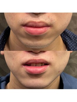 フェリーバ 浦和店(FELIVA)/Before&After