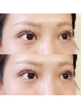 アール(R.)/エクパー LED×まつぱ 100本