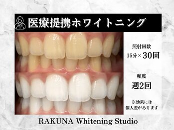 ラクナ(RAKUNA)/歯科医提携ホワイトニング症例
