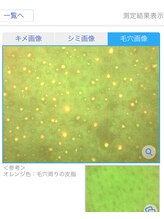 プリンセスフォー/毛穴の詰まったバイ菌画像も！