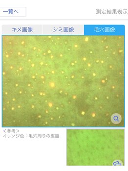プリンセスフォー/毛穴の詰まったバイ菌画像も！
