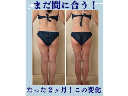 リノ(Lino)の写真