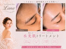 ラナ(Lana)