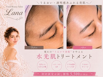 ラナ(Lana)の写真