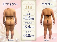 セラピアの雰囲気(オーダーメイド痩身コースによるボディライン変化例)