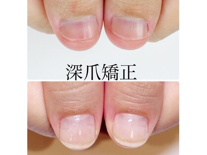 ネイルアンドアイラッシュ シシュ 高槻店(nail&eyelash SyiSyu)の写真