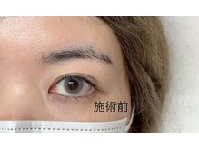 ブルージュ 自由が丘(Bruges)/ブラックティントパーマ　施術前