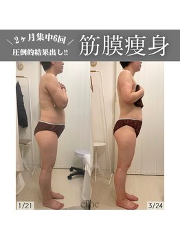 エルベ(ellbe)/ellbe式パワーレメディ筋膜痩身