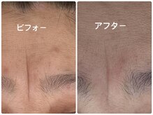 ノーブル シャット Noble Chate/実は、このシワあきらめてました