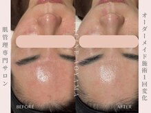 ファシネアオヤマ(FACINE AOYAMA)/肌本来の美しさへ♪