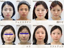 美デザイン 博多駅前店(美.design)