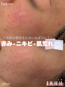 ジェノール 2nd beauty studio 姫路駅前店(JNOEL)/年末疲れの救世主！