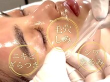 ボディメイキング キキ(Bodymaking KIKI)の雰囲気（水光ピーリングやシミケアなど、年齢とともに変化するお肌に◎）