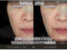 ダイヤモンドトゥルース(Diamond truth)/