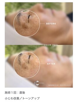 ユキエル(yukielle)/ビフォーアフター