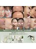 韓国発!本気の肌質改善スキンケア体験(カウンセリング付)水光肌ケア