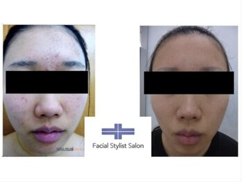 フェイシャルスタイリストサロン 四谷店/ケア例(21)