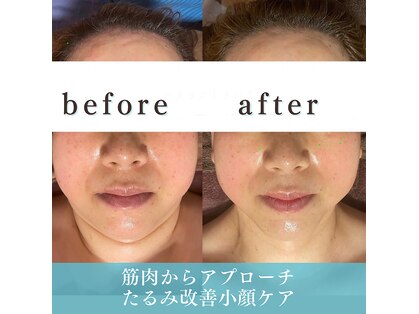 ラヒル(Lahir)の写真