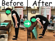 杉本接骨鍼灸院/腰が曲がらなかったのに