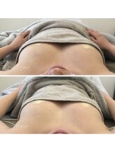 サロン ワン(salon one)/ビフォーアフター