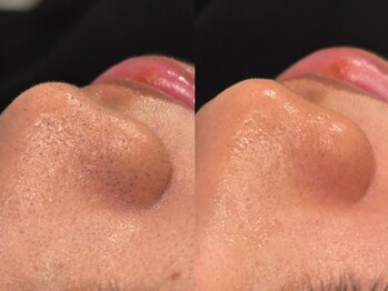 クラウン 心斎橋店(CROWN)/