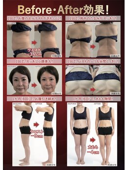 スーパースカルプ 大津店(SuperScalp)/ナリスキャビ