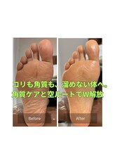 ウテナ(UTENA)/角質ケア