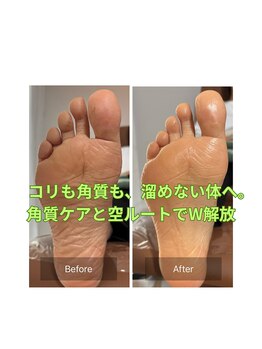 ウテナ(UTENA)/角質ケア