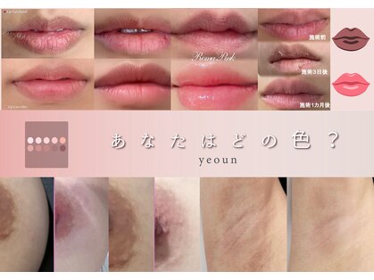 韓国肌管理yeoun【ヨウン】ROMAPINK/黒ずみ/毛穴/プラピール/ララピール福岡天神の写真