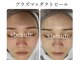 エスボーテ(sbeaute)の写真