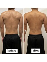 東京デトックス/バキバキ背中こり改善