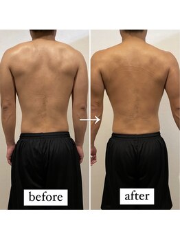 東京デトックス/バキバキ背中こり改善