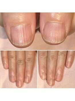 ココデネイル(cocode nail)/悩み:さかむけ、乾燥(40代前半)