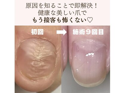 ポノポ(ponopo)の写真