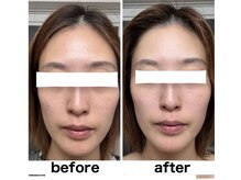 ラフルール(LA FLEUR)/よもぎ蒸し