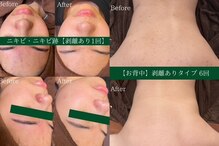 エミルカ 土岐店(EMILUCA)