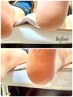 【移転記念】感動のツルふわ♪目指せ赤ちゃん肌! 角質ケア ¥6000