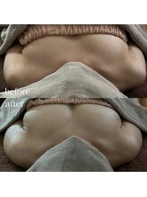 リュウ(le.lieu)/バストケア1回の変化