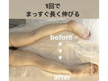 メゾン ド クロエ(Maison de Chloe)/CHLOE式パーソナル痩身