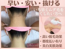 ブランリス 京都店(Blanclis)の雰囲気（絶対抜ける全身脱毛！光脱毛の最高峰マシン導入！！）
