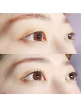 アール(R.)/エクパー LED×まつぱ　80本