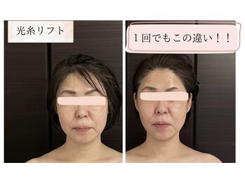 ホルバールウェルネス(Hallbar Wellness)/こんなの初めて！