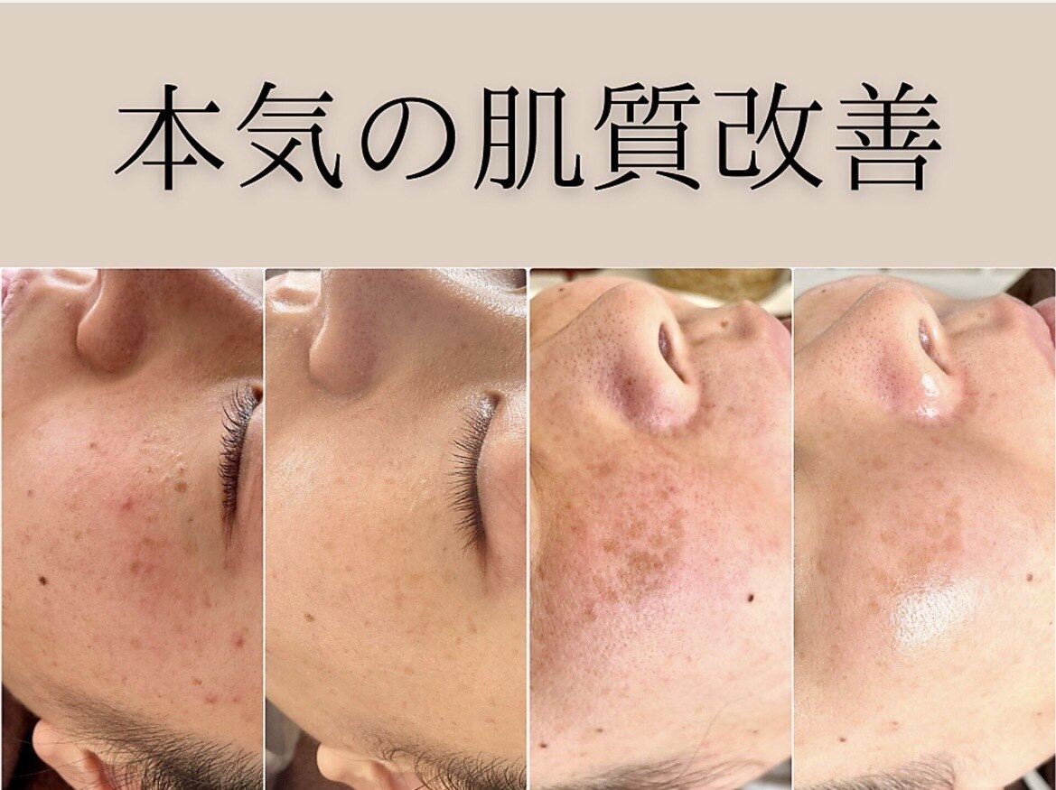アイビーケア 三田(ivy care)｜ホットペッパービューティー