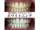 ヤット 森ノ宮(yatto.)の写真/歯科衛生士による施術で、歯本来の憧れの白さに導きます♪お悩みお気軽にご相談ください！
