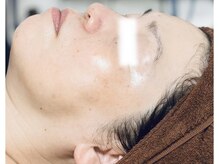 メディカルサロン かとれあ/お客様のお肌